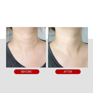 Medi-Peel Premium 2.0 Collagen Naite Thread Halscreme