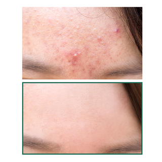 Miracle Cleansing Bar by Some By Mi